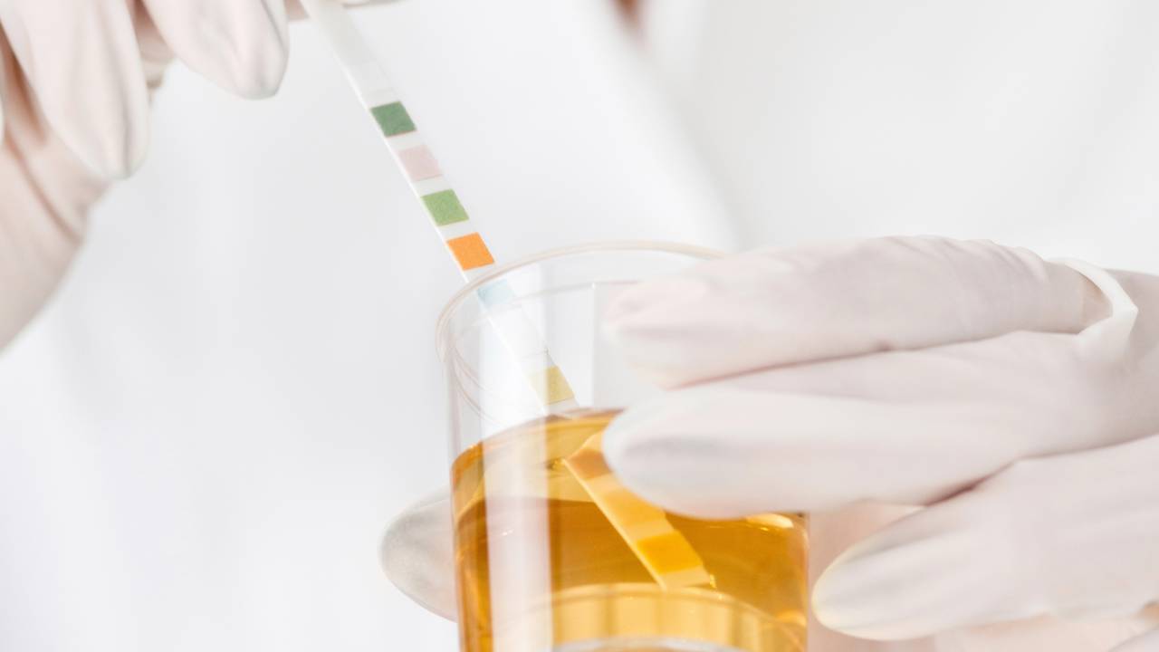 O que significa quando a cor da urina muda de repente