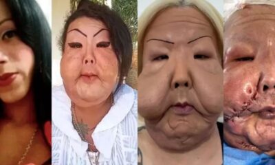 Juju do Pix enfrenta cirurgia arriscada e resultado surpreende a web