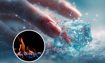 Por que o gelo pode queimar como fogo mesmo sendo gelado?