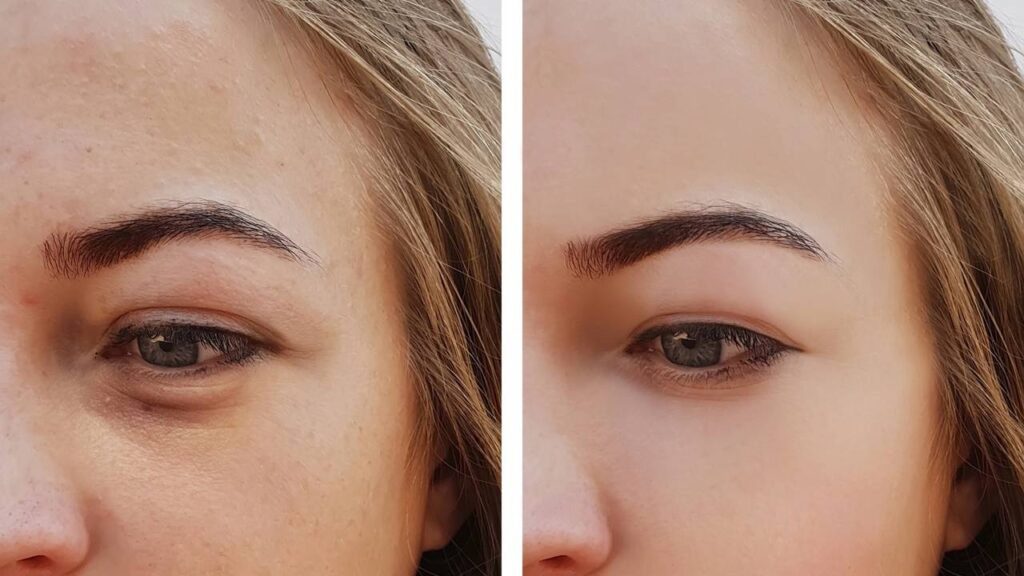 Como disfarçar olheiras e manter a maquiagem leve por mais tempo