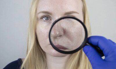 Erros que deixam sua pele oleosa e aceleram o envelhecimento