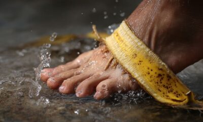 Coloquei casca de banana nos pés e minha pele mudou já na primeira noite