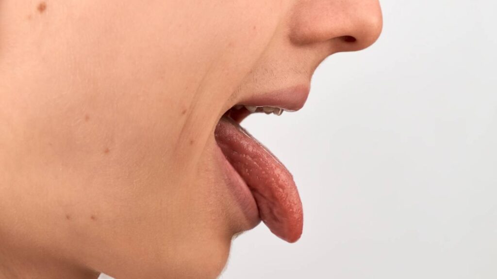 Gosto amargo na boca? Veja 10 causas e como resolver em 6 passos