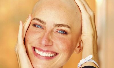 Atriz relata rotina de quimioterapia após descobrir câncer de forma inesperada: “Impossível esconder”