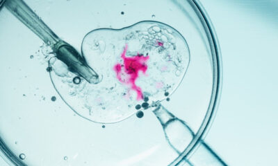 Fertilização in Vitro: 8 informações essenciais para entender o tratamento