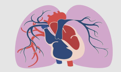 Hipertensão arterial pulmonar: entenda a doença de Lígia em “Três Graças”