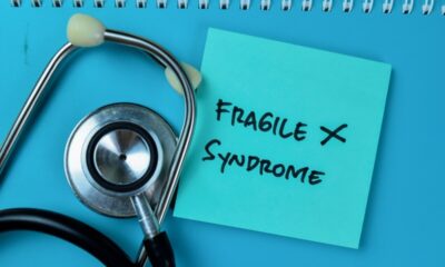 Síndrome do X Frágil: conheça as causas e os sintomas