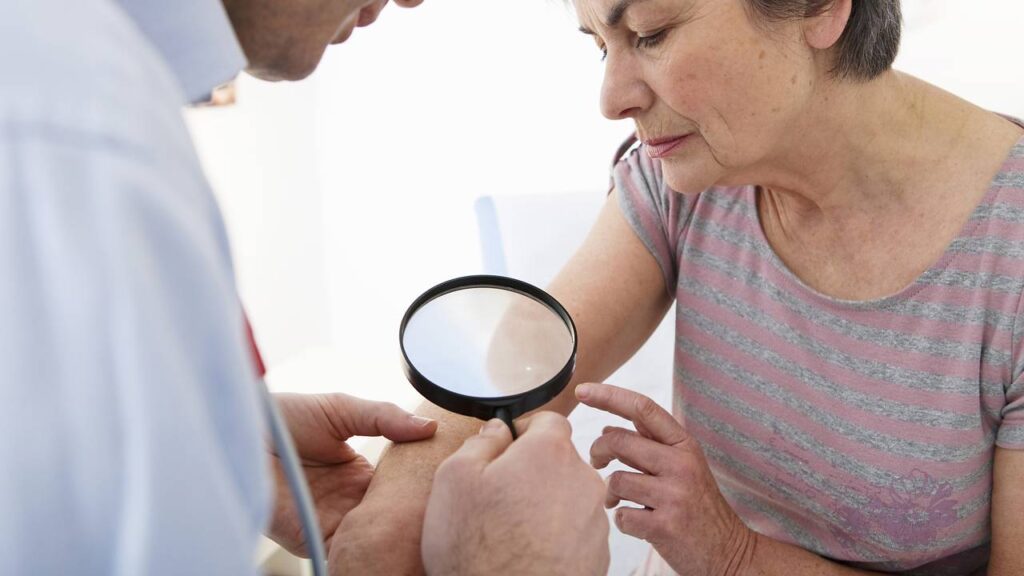 Conheça os sintomas do câncer de pele e entenda por que notar alterações no corpo ajuda na busca por avaliação profissional
