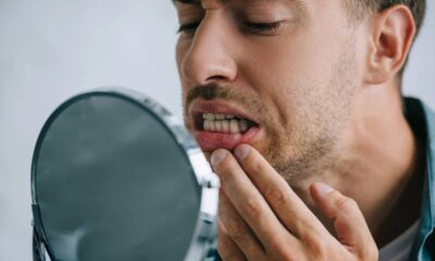 Dor nos dentes por sensibilidade! O que causa e como tratar