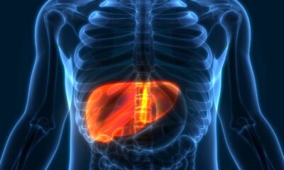 Como limpar o fígado em 10 dias e sentir a diferença no corpo