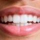 Verdade sobre quanto custa clarear os dentes em casa x clareamento profissional