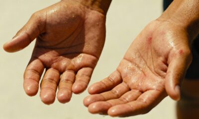 Quando o suor nas mãos aparece do nada, um sinal forte do corpo pode estar acontecendo