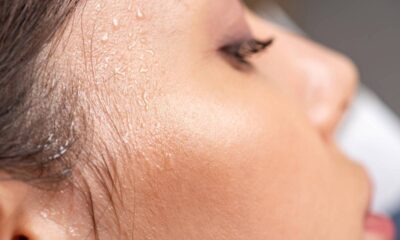 Os sintomas do suor excessivo que indicam sudorese