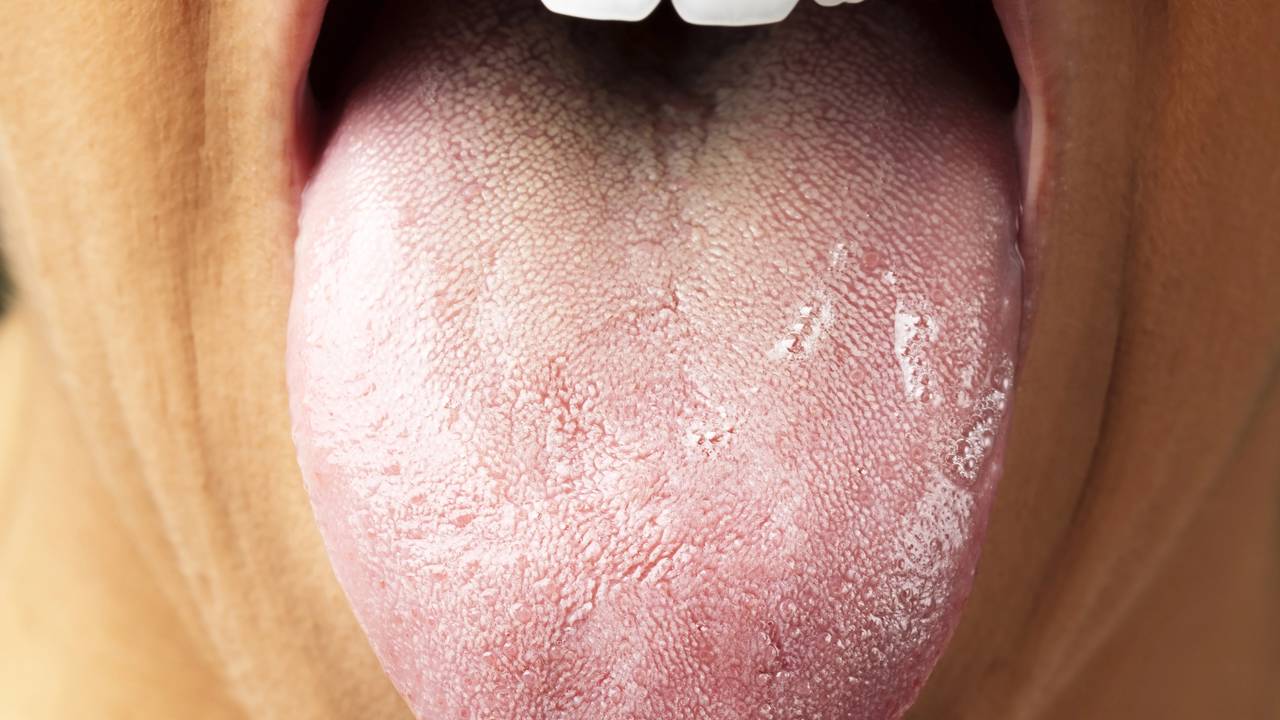 Língua mudando de cor pode ser um alerta importante do seu organismo