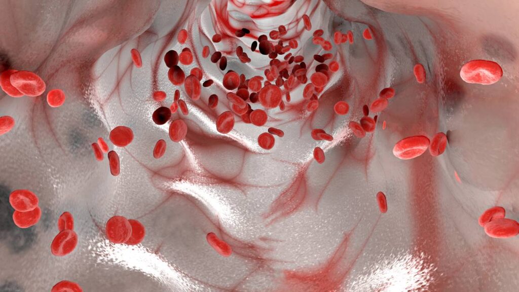 10 alimentos que limpam os vasos sanguíneos e os 5 que devem ser evitados