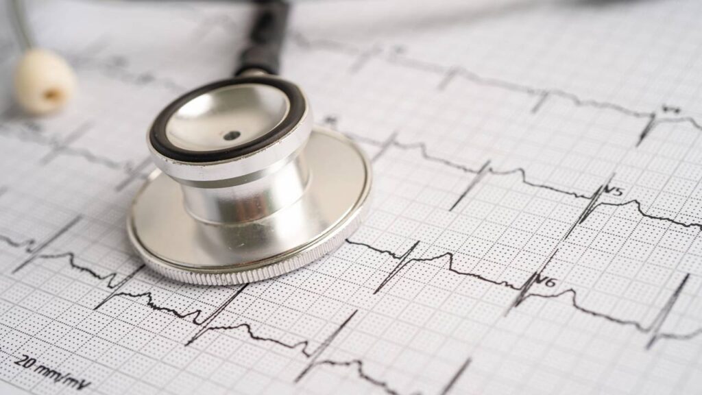 7 sinais de arritmia cardíaca que indicam alterações no ritmo do coração