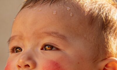Bebê com a cabeça quente preocupa? Entenda quando é normal e quando observar melhor