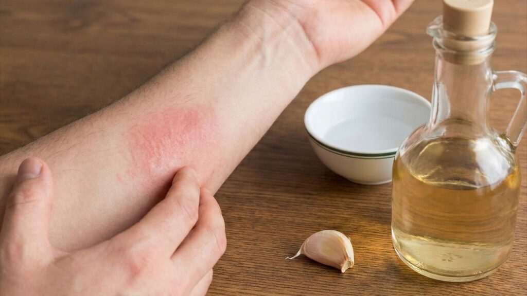 Mistura poderosa com alho e vinagre promete acabar com os fungos nas unhas hoje mesmo!