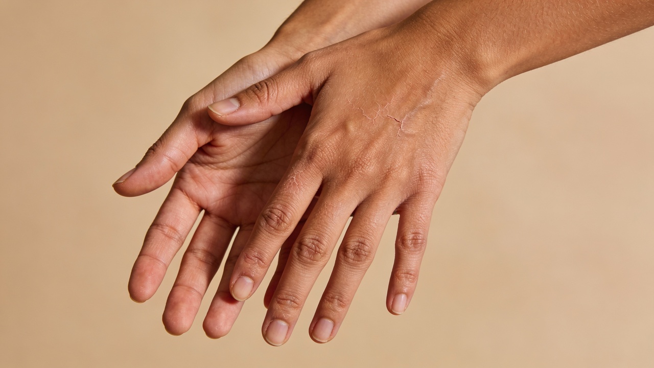 Pare de usar cremes caros e recupere suas mãos ressecadas com apenas três ingredientes
