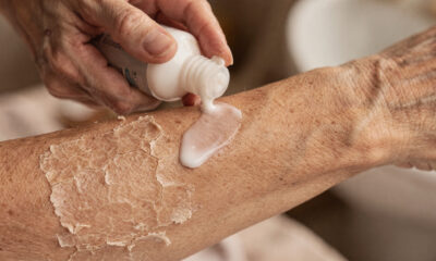 Saiba quais são os cuidados com a pele do idoso fundamentais no dia a dia