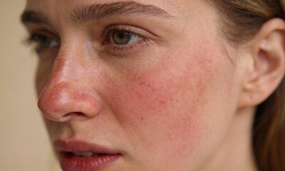 Melhores itens de skincare e produtos indispensáveis para tratar a pele sensível com vermelhidão