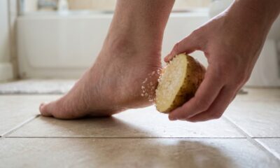 Como batata e sal ajudam a deixar os calcanhares mais macios em casa