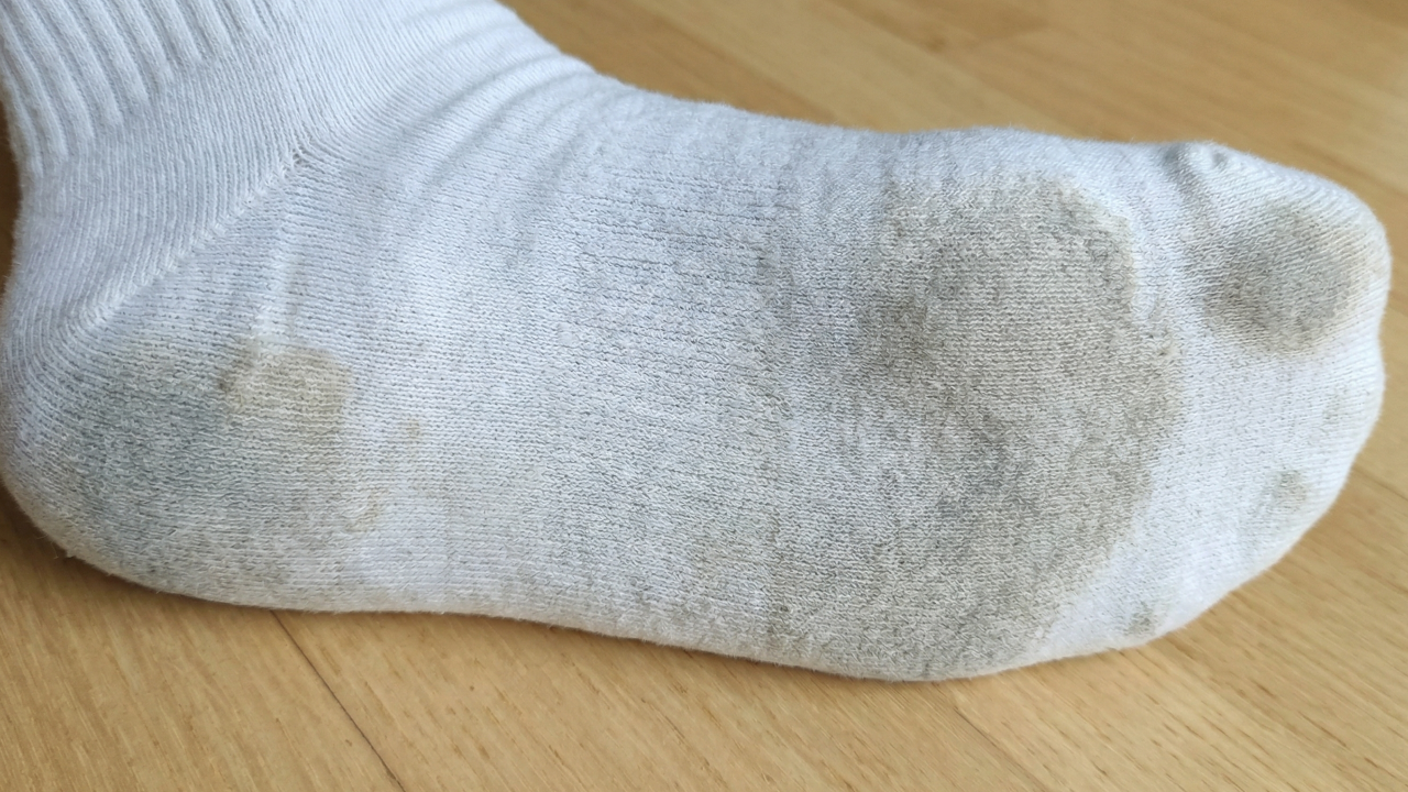 Adeus meias encardidas: este método simples devolve o branco sem esforço e sem produto agressivo