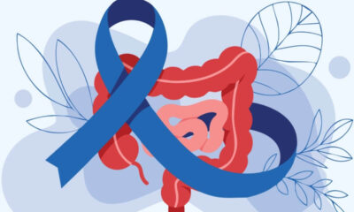 Março Azul-Marinho: veja atividades físicas que ajudam no combate ao câncer colorretal