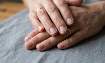 Nem sempre é só esmalte ou fraqueza: o que pode faltar quando as unhas vivem quebrando