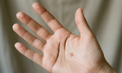 Olhe abaixo do dedo indicador: esse sinal raro na mão é cercado por mistério e leituras curiosas