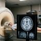 Nova pesquisa desafia teoria histórica sobre amadurecimento cerebral no TDAH