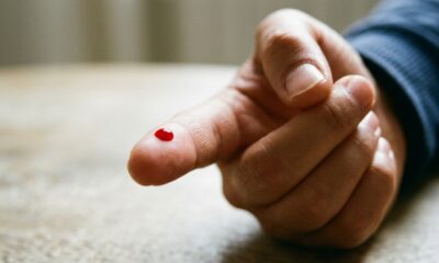 Novo teste detecta sinais de câncer com apenas uma gota de sangue em 15 minutos
