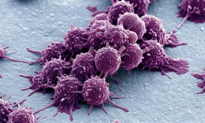 Vitamina B2 pode ajudar células cancerosas a sobreviver, aponta pesquisa
