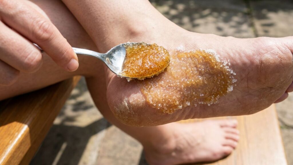 Misture esses 2 ingredientes e sinta sua pele mais macia na hora