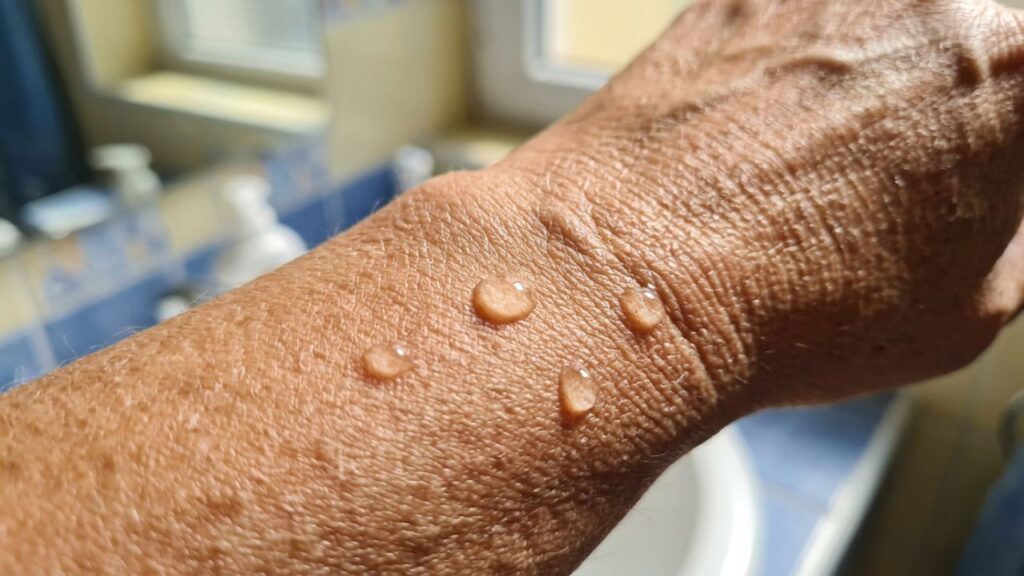 Eu mudei apenas um detalhe na rotina e minha pele aos 60 anos nunca esteve tão bonita