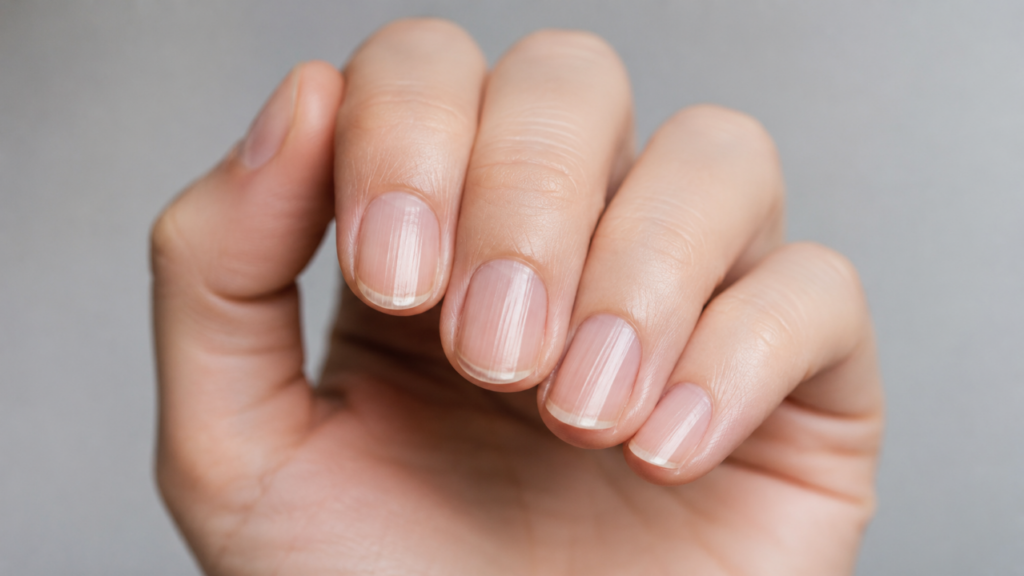 Linhas nas unhas podem parecer detalhe, mas esse sinal mostra quando vale investigar a saúde