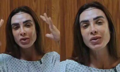 Mulher com linha de transplante capilar marcada na testa e sobrancelhas desenhadas, em veste médica.