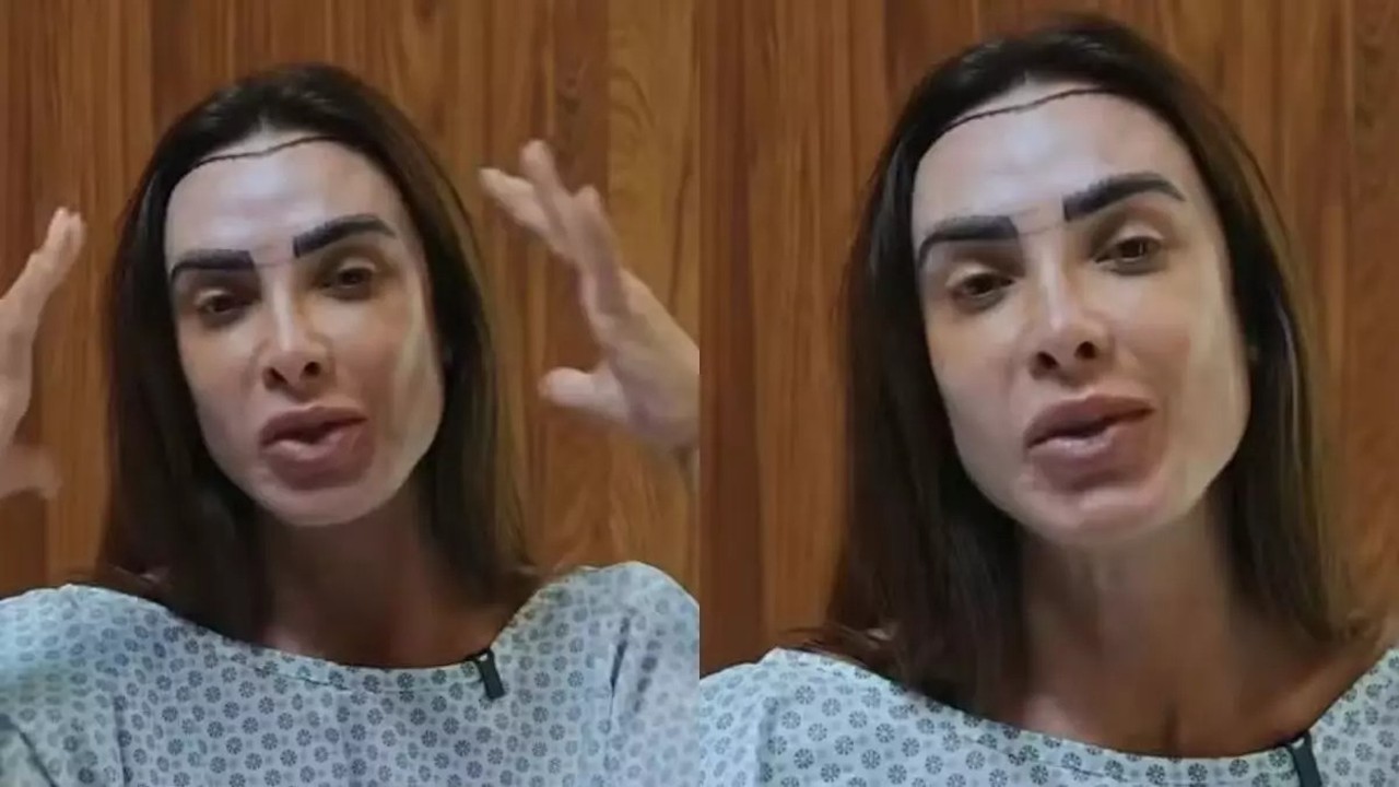 Mulher com linha de transplante capilar marcada na testa e sobrancelhas desenhadas, em veste médica.