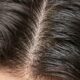 Com que frequência você deve lavar o cabelo? Seu couro cabeludo indica a frequência ideal
