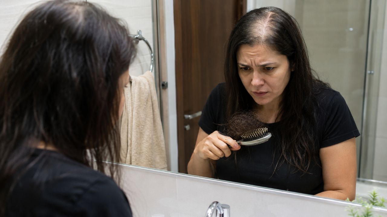 Queda de cabelo se você notar algum destes 6 sinais, deve se preocupar