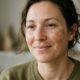Melasma: o que é? Como tratar e como clarear manchas no rosto