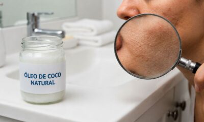 Óleo de coco no rosto: o segredo de beleza que exige cuidado antes de usar