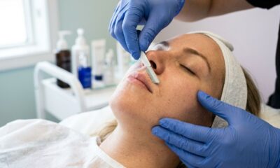 Você não precisa mais sofrer com a depilação facial tradicional: conheça a técnica de alta precisão que remove os pelos e as células mortas de forma indolor