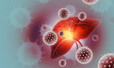 Julho Amarelo: 4 mitos e verdades sobre a transmissão das hepatites virais