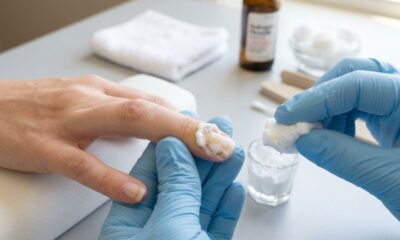 Esta mistura caseira simples pode ajudar a suavizar as manchas e recuperar a aparência natural das unhas amareladas após a retirada do esmalte