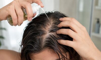 Mistura barata com ingredientes de casa pode ajudar no cuidado de quem tem alopecia