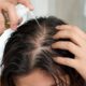 Mistura barata com ingredientes de casa pode ajudar no cuidado de quem tem alopecia