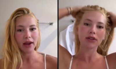 Virginia Fonseca em vídeo com rosto avermelhado e inchado, tocando o cabelo na segunda imagem