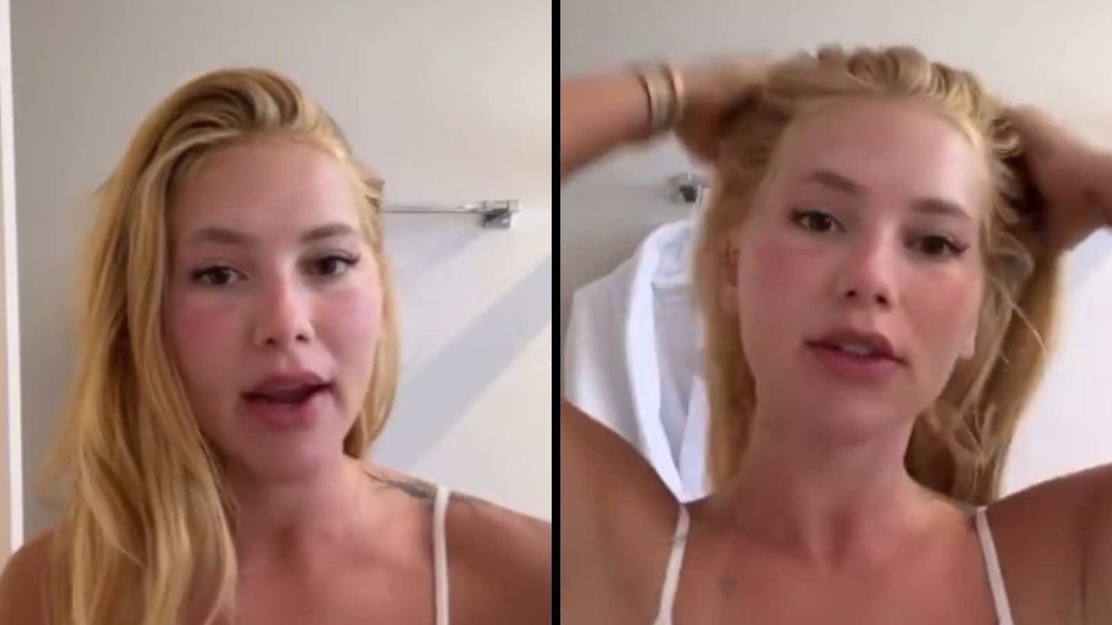 Virginia Fonseca em vídeo com rosto avermelhado e inchado, tocando o cabelo na segunda imagem