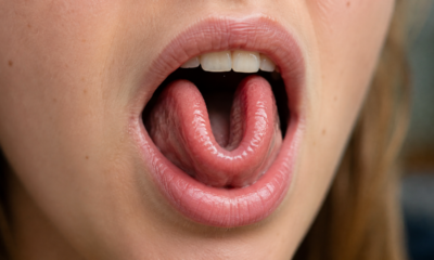 O que significa conseguir dobrar a língua em forma de U e por que nem todo mundo consegue